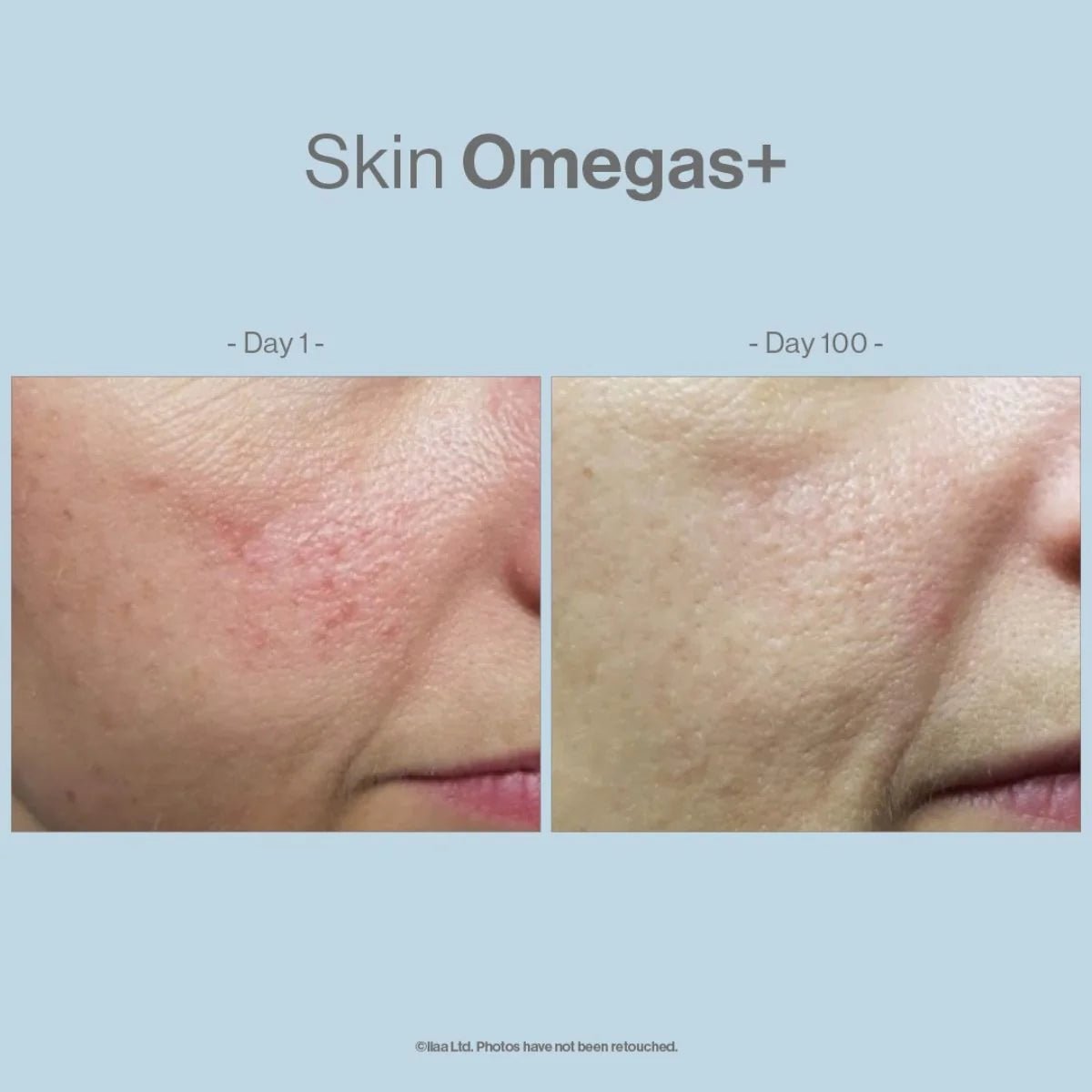 Skin Omegas+ - The Kelly Clinic