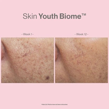 Skin Youth Biome™ - The Kelly Clinic